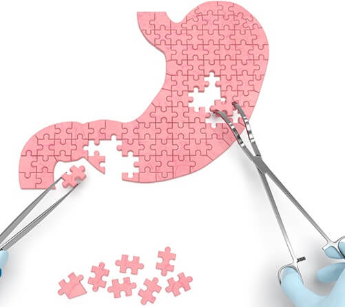 amor-ygb-mraaaatha-kbl-agraaa-aamlyat-grahy-lmaaalg-alsmn