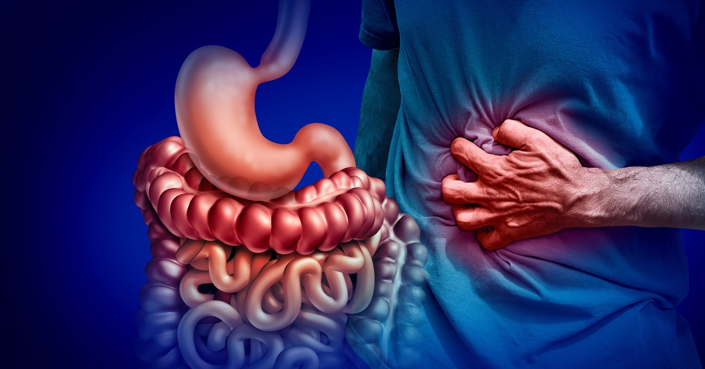 crohns-disease
