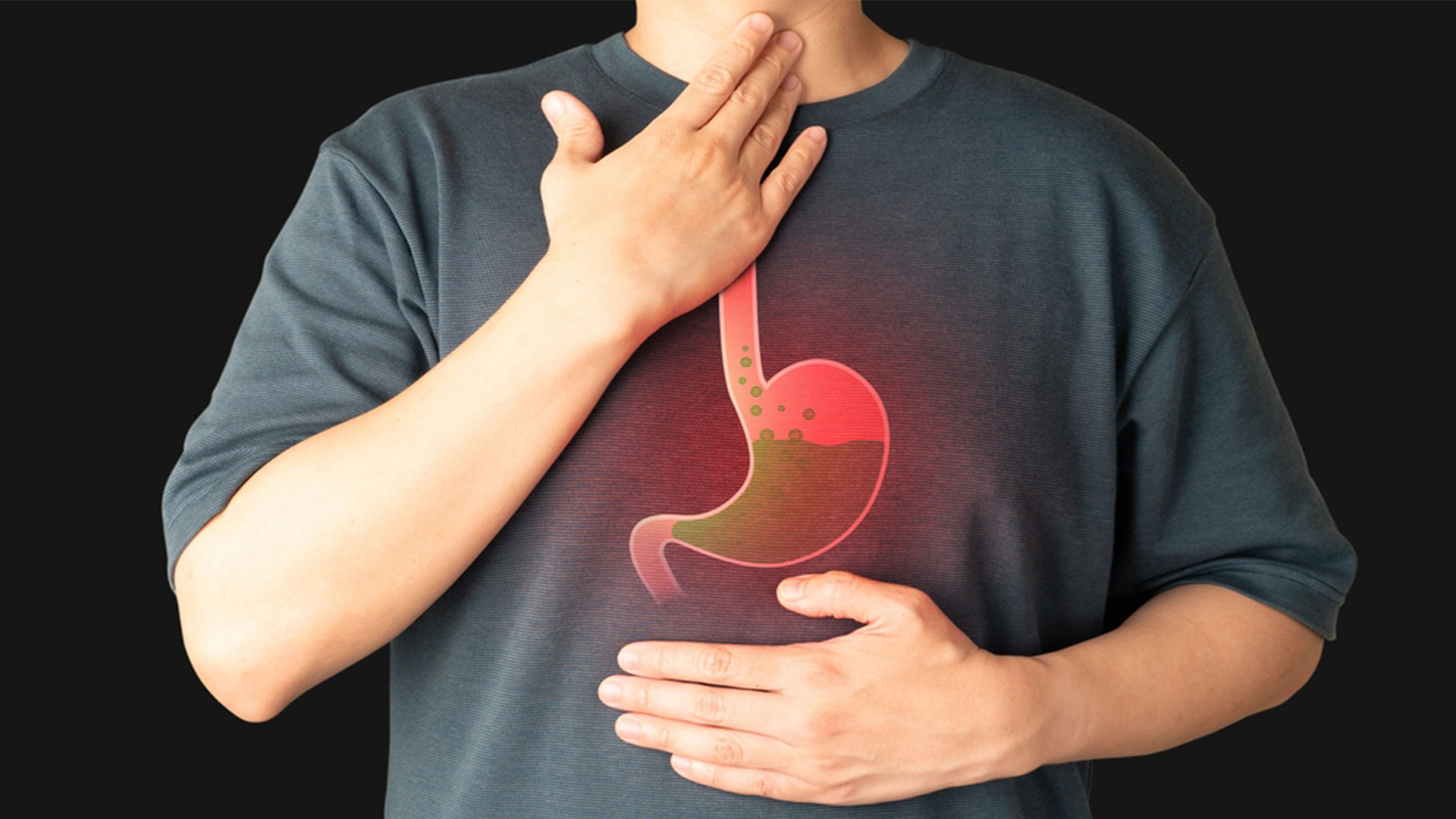 relationship-between-nutrition-and-gastroesophageal-reflux-disease-gerd